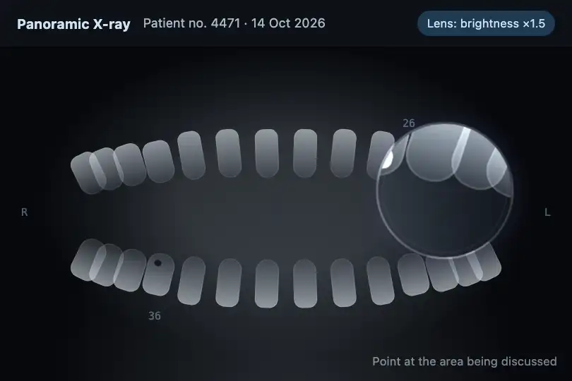 Examining a panoramic X-ray — a dental practice's software — Liquid Lens Magnifier example 3