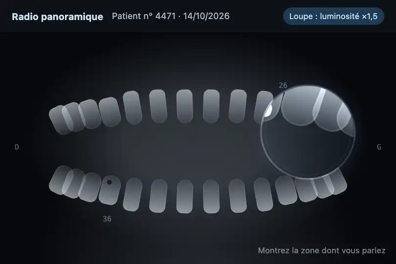 Examiner une radio panoramique — logiciel d'un cabinet dentaire — Liquid Lens Magnifier exemple 3