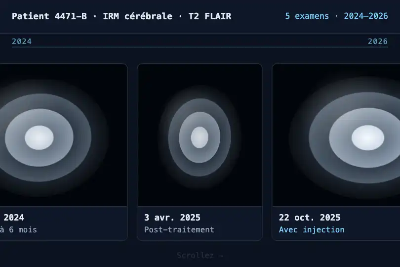 Bande d'imageries chronologiques — application de radiologie sur tablette — Horizontal Scroll exemple 2